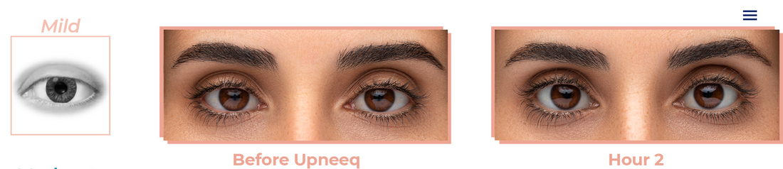 Upneeq (Prescription required)