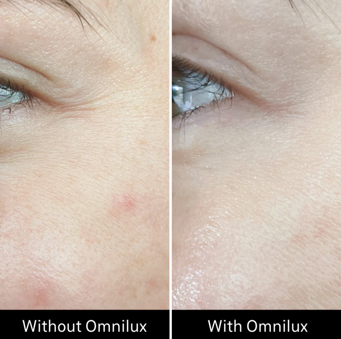 Omnilux Contour Face Red Light Therapy