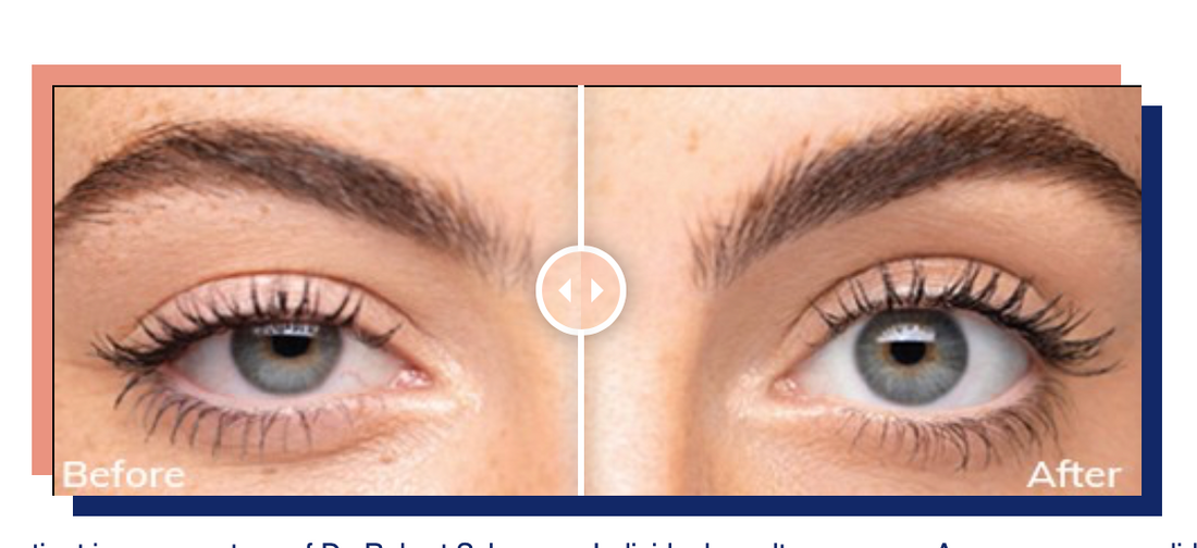 Upneeq (Prescription required)